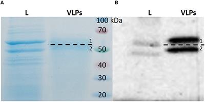 Development of modern immunization agent against bovine papillomavirus type 1 infection based on BPV1 L1 recombinant protein